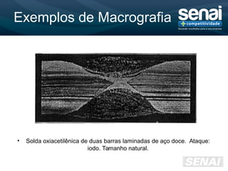 Exemplos de Macrografia
• Solda oxiacetilênica de duas barras laminadas de aço doce. Ataque:
iodo. Tamanho natural.
 