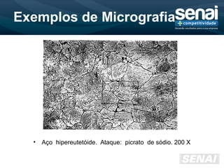 Exemplos de Micrografia
• Aço hipereutetóide. Ataque: picrato de sódio. 200 X
 
