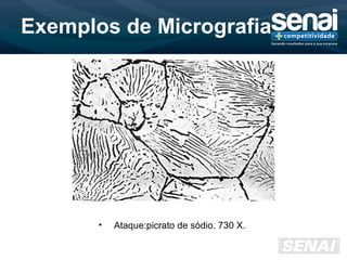 Exemplos de Micrografia
• Ataque:picrato de sódio. 730 X.
 