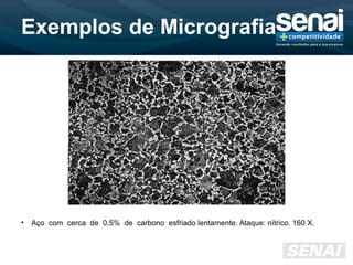 Exemplos de Micrografia
• Aço com cerca de 0,5% de carbono esfriado lentamente. Ataque: nítrico. 160 X.
 