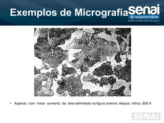 Exemplos de Micrografia
• Aspecto com maior aumento da área delimitada na figura anterior. Ataque: nítrico. 800 X
 