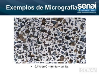 Exemplos de Micrografia
• 0,4% de C – ferrita + perlita
 