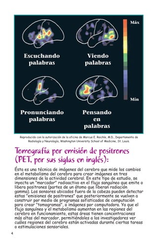 4
Tomografía por emisión de positrones
(PET, por sus siglas en inglés):
Ésta es una técnica de imágenes del cerebro que mide los cambios
en el metabolismo del cerebro para crear imágenes en tres
dimensiones de la actividad cerebral. En este tipo de estudio, se
inyecta un "marcador" radioactivo en el flujo sanguíneo que emite o
libera positrones (partes de un átomo que liberan radiación
gamma). Los sensores ubicados fuera de la cabeza pueden detectar
estas "emisiones de positrones" que posteriormente se vuelven a
construir por medio de programas sofisticados de computación
para crear "tomogramas", o imágenes por computadora. Ya que el
flujo sanguíneo y el metabolismo aumentan en las regiones del
cerebro en funcionamiento, estas áreas tienen concentraciones
más altas del marcador, permitiéndoles a los investigadores ver
cuáles regiones del cerebro están activadas durante ciertas tareas
o estimulaciones sensoriales.
Escuchando Viendo
palabras palabras
Pronunciando Pensando
palabras en
palabras
Máx
Mín
Reproducido con la autorización de la oficina de Marcus E. Raichle, M.D., Departamento de
Radiología y Neurología, Washington University School of Medicine, St. Louis.
 