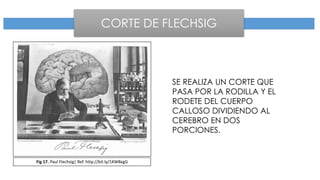 CORTE DE FLECHSIG
SE REALIZA UN CORTE QUE
PASA POR LA RODILLA Y EL
RODETE DEL CUERPO
CALLOSO DIVIDIENDO AL
CEREBRO EN DOS
PORCIONES.
Fig 17. Paul Flechsig| Ref. http://bit.ly/1KW8xgG
 