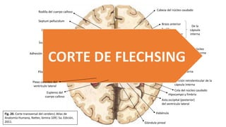 Cabeza del núcleo caudado
Rodilla
Glándula pineal
Cola del núcleo caudado
Columna del fórnix
Septum pellucidum
Brazo anterior
Brazo posterior
De la
cápsula
interna
Cápsula extrema
Putamen
Globo pálido
Núcleo
lentiforme
3.er ventrículo
Cápsula externa
Claustro
Porción retrolenticular de la
cápsula interna
Hipocampo y fimbria
Asta occipital (posterior)
del ventrículo lateral
Habénula
Rodilla del cuerpo calloso
Ínsula (de Reil)
Adhesión intertalámica
Tálamo
Pilar del fórnix
Plexo coroideo del
ventrículo lateral
Esplenio del
cuerpo calloso
Fig. 20. Corte transversal del cerebro| Atlas de
Anatomía Humana, Netter, lámina 109| 5a. Edición,
2011.
 