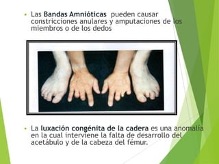  Las Bandas Amnióticas pueden causar
constricciones anulares y amputaciones de los
miembros o de los dedos
 La luxación congénita de la cadera es una anomalía
en la cual interviene la falta de desarrollo del
acetábulo y de la cabeza del fémur.
 