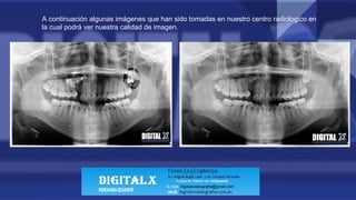 A continuación algunas imágenes que han sido tomadas en nuestro centro radiologico en
la cual podrá ver nuestra calidad de imagen.
E-mail: Digitalxradiografia@gmail.com
 