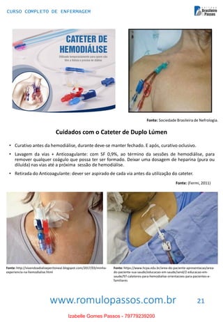 www.romulopassos.com.br
CURSO COMPLETO DE ENFERMAGEM
21
Fonte: Sociedade Brasileira de Nefrologia.
Cuidados com o Cateter de Duplo Lúmen
• Curativo antes da hemodiálise, durante deve-se manter fechado. E após, curativo oclusivo.
• Lavagem da vias + Anticoagulante: com SF 0,9%, ao término da sessões de hemodiálise, para
remover qualquer coágulo que possa ter ser formado. Deixar uma dosagem de heparina (pura ou
diluída) nas vias até a próxima sessão de hemodiálise.
• Retirada do Anticoagulante: dever ser aspirado de cada via antes da utilização do cateter.
Fonte: (Fermi, 2011)
Fonte: http://vivendoadialiseperitoneal.blogspot.com/2017/03/minha-
experiencia-na-hemodialise.html
Fonte: https://www.hcpa.edu.br/area-do-paciente-apresentacao/area-
do-paciente-sua-saude/educacao-em-saude/send/2-educacao-em-
saude/97-cateteres-para-hemodialise-orientacoes-para-pacientes-e-
familiares
Izabelle Gomes Passos - 79779239200
 