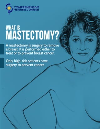 Masterctomy Types Mastectomy- Whats and Whys | PDF