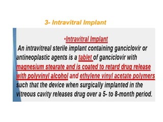 3- Intravitral Implant
 