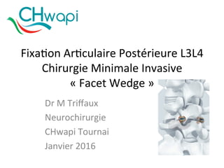 Fixa%on	
  Ar%culaire	
  Postérieure	
  L3L4	
  
Chirurgie	
  Minimale	
  Invasive	
  
«	
  Facet	
  Wedge	
  »	
  	
  
Dr	
  M	
  Triﬀaux	
  	
  
Neurochirurgie	
  	
  
CHwapi	
  Tournai	
  
Janvier	
  2016	
  
	
  	
  
 
