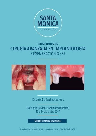 CIRUGÍA AVANZADA EN IMPLANTOLOGÍA Dirigido a dentistas y cirujanos cursos@santamonicaformacion.es 
CURSO HANDS-ON 
CIRUGÍA AVANZADA EN IMPLANTOLOGÍA 
- REGENERACIÓN ÓSEA - 
Dictante: Dr. Sascha Jovanovic 
Hotel Asia Gardens - Benidorm (Alicante) 
13 y 14 diciembre 2014 
Dirigido a Dentistas y Cirujanos 
Teléfono. (+34) 636 412 052 www.santamonicaformacion.es 
Inscríbase en cursos@santamonicaformacion.es o en el tlf: (+34) 636 412 052. 
 