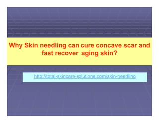 Why Skin needling can cure concave scar and
         fast recover aging skin?


       http://total-skincare-solutions.com/skin-
       http://total-skincare-solutions.com/skin-needling
 