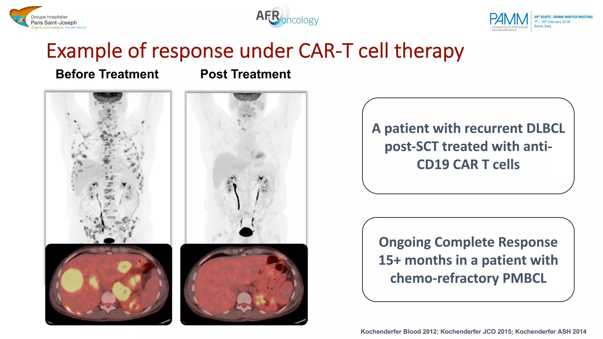 Scans from Dr. Rosenberg NCI
Ongoing Complete Response
15+ months in a patient with
chemo-refractory PMBCL
A patient with recurrent DLBCL
post-SCT treated with anti-
CD19 CAR T cells
Example of response under CAR-T cell therapy
Before Treatment Post Treatment
Kochenderfer Blood 2012; Kochenderfer JCO 2015; Kochenderfer ASH 2014
 