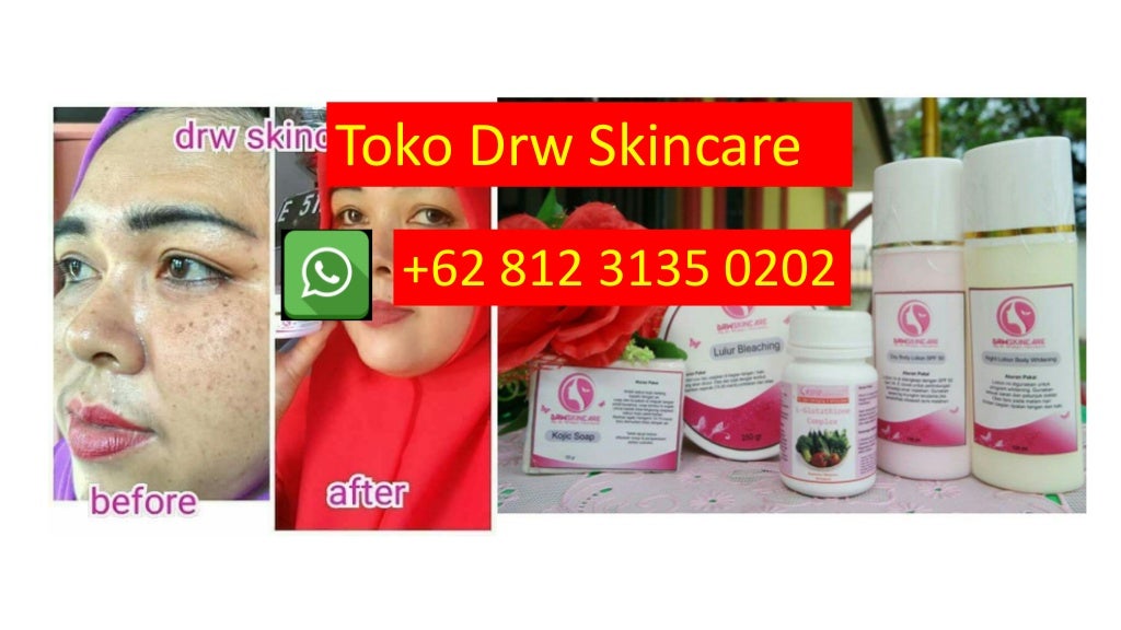 PALING AMPUH, WA +62 812 3135 0202, Cara Membersihkan Bekas Jerawat U…