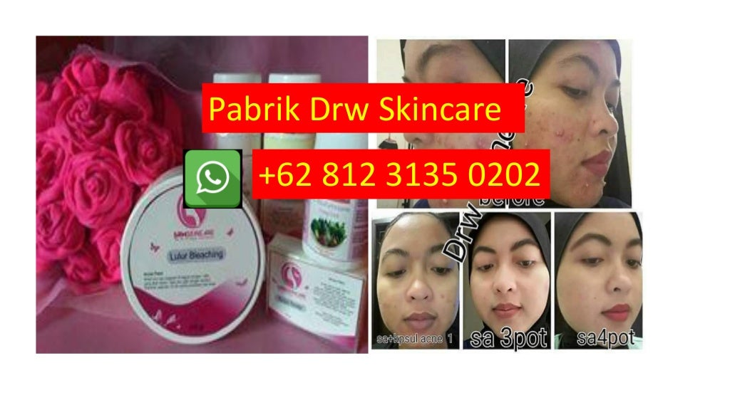 PALING AMPUH, WA +62 812 3135 0202, Cara Membersihkan Bekas Jerawat U…