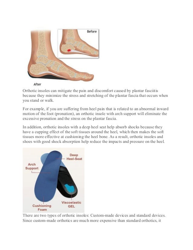 How Orthotic Insoles Can Help Plantar Fasciitis