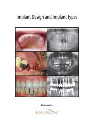 Implant Design and ImplantTypes
Sponsored by:
 