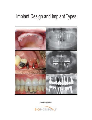 Implant Design and ImplantTypes.
Sponsored by:
 