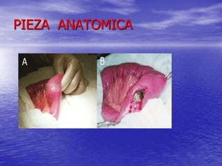 PIEZA ANATOMICA

 