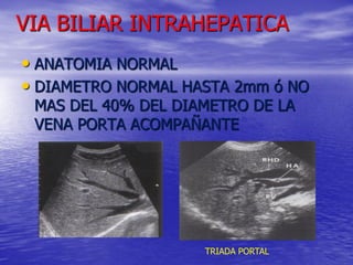 VIA BILIAR INTRAHEPATICA
• ANATOMIA NORMAL
• DIAMETRO NORMAL HASTA 2mm ó NO
MAS DEL 40% DEL DIAMETRO DE LA
VENA PORTA ACOMPAÑANTE

TRIADA PORTAL

 
