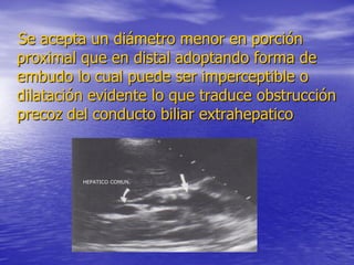 Se acepta un diámetro menor en porción
proximal que en distal adoptando forma de
embudo lo cual puede ser imperceptible o
dilatación evidente lo que traduce obstrucción
precoz del conducto biliar extrahepatico

HEPATICO COMUN.

 