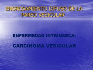 ENGROSAMIENTO DIFUSO DE LA
PARED VESICULAR

ENFERMEDAD INTRINSECA:

CARCINOMA VESICULAR

 