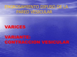 ENGROSAMIENTO DIFUSO DE LA
PARED VESICULAR
VARICES
VARIANTE:
CONTRACCION VESICULAR

 