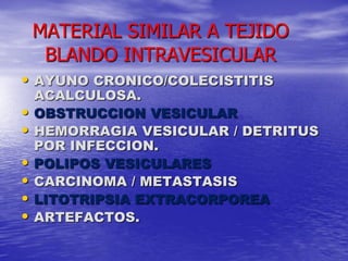 MATERIAL SIMILAR A TEJIDO
BLANDO INTRAVESICULAR
• AYUNO CRONICO/COLECISTITIS

•
•
•
•
•
•

ACALCULOSA.
OBSTRUCCION VESICULAR
HEMORRAGIA VESICULAR / DETRITUS
POR INFECCION.
POLIPOS VESICULARES
CARCINOMA / METASTASIS
LITOTRIPSIA EXTRACORPOREA
ARTEFACTOS.

 