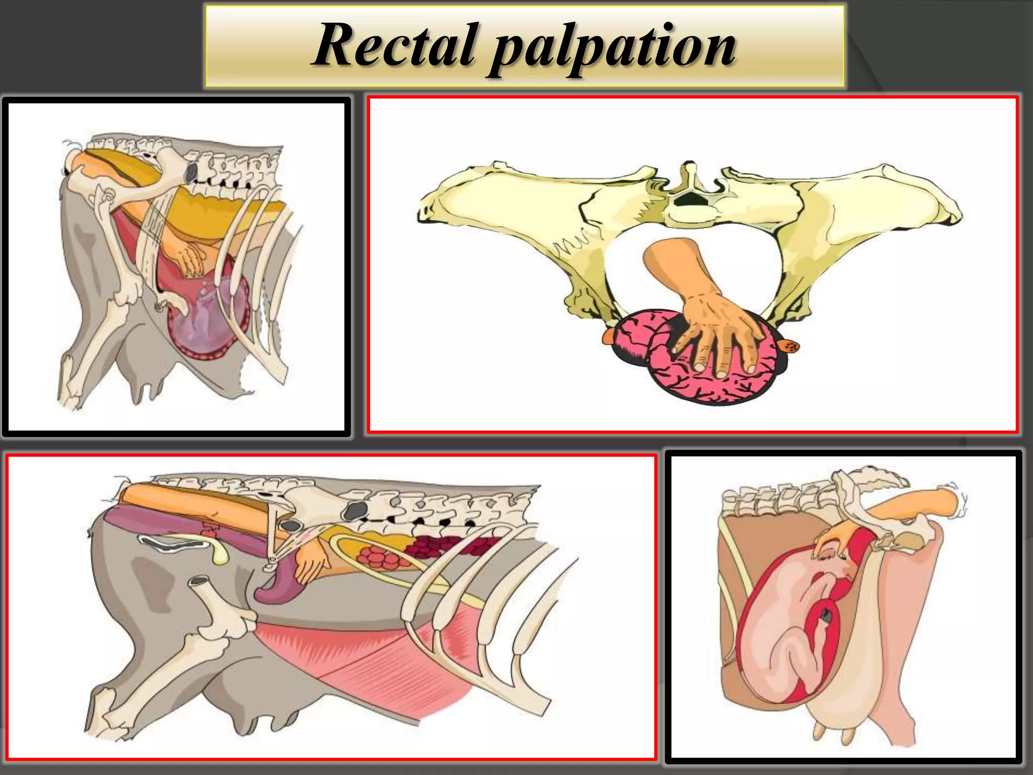 Rectal palpation
 