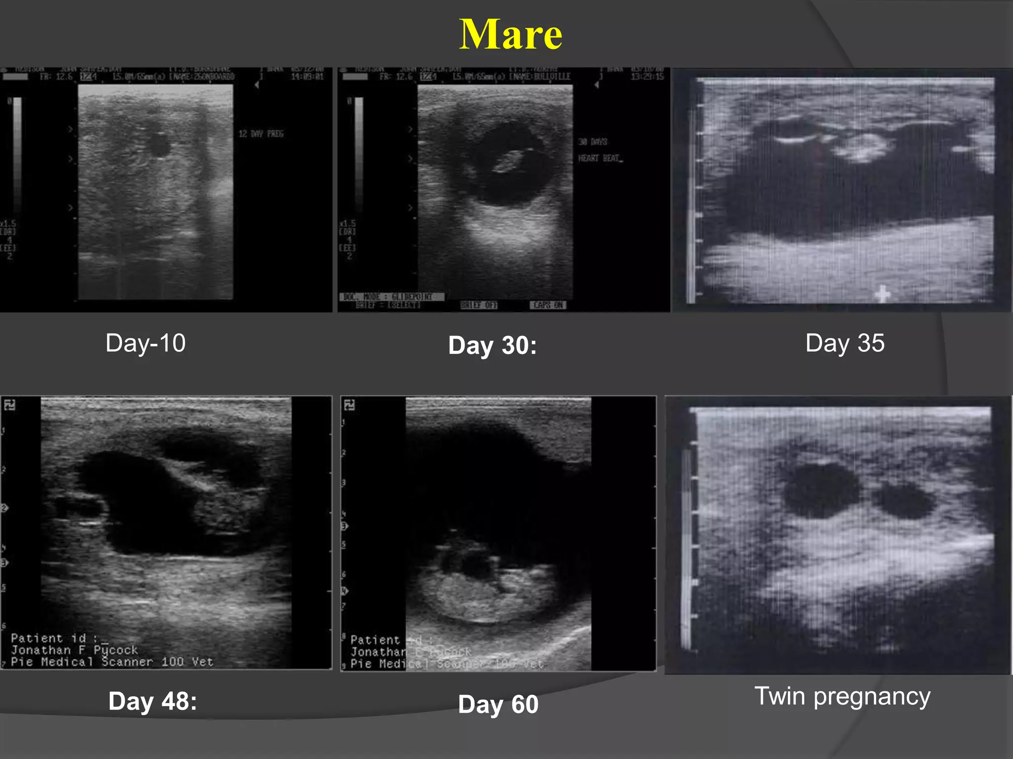 Day-10 Day 30:
Day 48: Day 60
Day 35
Twin pregnancy
Mare
 
