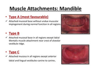 Muscle Attachments: Mandible
• Type A (most favourable)
 Attached mucosal base without undue muscular
impingement during normal function in all regions.
• Type B
 Attached mucosal base in all regions except labial
Mentalis muscle attachment near crest of alveolar
vestibule ridge.
• Type C
 Attached mucosa in all regions except anterior
labial and lingual vestibules-canine to canine.
 