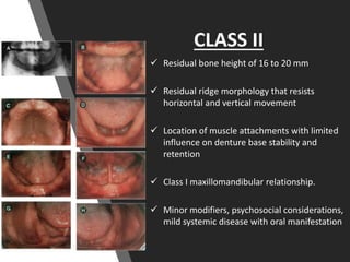 CLASS II
 Residual bone height of 16 to 20 mm
 Residual ridge morphology that resists
horizontal and vertical movement
 Location of muscle attachments with limited
influence on denture base stability and
retention
 Class I maxillomandibular relationship.
 Minor modifiers, psychosocial considerations,
mild systemic disease with oral manifestation
 