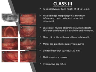 CLASS III
 Residual alveolar bone height of 11 to 15 mm
 Residual ridge morphology has minimum
influence to resist horizontal or vertical
movement
 Location of muscle attachments with moderate
influence on denture base stability and retention.
 Class I, II, or III maxillomandibular relationship
 Minor pre-prosthetic surgery is required
 Limited inter-arch space (18-20 mm)
 TMD symptoms present
 Hyperactive gag reflex
 