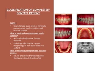CLASSIFICATION OF COMPLETELY
DENTATE PATIENT
CLASS I
• Characterized by an ideal or minimally
compromised tooth condition and
occlusal scheme.
Ideal or minimally compromised tooth
condition
• No localized adjunctive therapy
required.
• Pathology affecting the coronal
morphology of 3 or fewer teeth in a
sextant.
Ideal or minimally compromised occlusal
scheme
• No pre-prosthetic therapy required.
Contiguous, intact dental arches
 