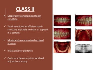 CLASS II
• Moderately compromised tooth
condition
 Tooth condition insufficient tooth
structure available to retain or support
in 1 sextant.
• Moderately compromised occlusal
scheme
 Intact anterior guidance
 Occlusal scheme requires localized
adjunctive therapy.
 