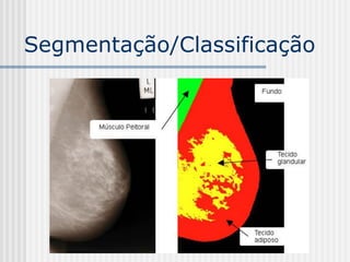 Segmentação/Classificação
 