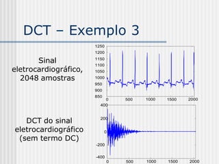 DCT – Exemplo 3
                       1250
                       1200

       Sinal           1150
                       1100
eletrocardiográfico,   1050

  2048 amostras        1000
                       950
                       900
                       850
                              0   500   1000   1500   2000
                         400



   DCT do sinal          200

eletrocardiográfico          0
 (sem termo DC)
                       -200


                       -400
                              0   500   1000   1500   2000
 
