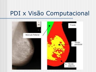 PDI x Visão Computacional
 