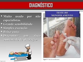 DIAGNÓSTICODIAGNÓSTICO
 Muito usado por nãoMuito usado por não
especialistas.especialistas.
 Grande sensibilidade.Grande sensibilidade.
 Simples execução.Simples execução.
 Baixo custo.Baixo custo.
 Determina um riscoDetermina um risco
aumentado de ulceraçãoaumentado de ulceração..
TESTE DOTESTE DO
MONOFILAMENTOMONOFILAMENTO
 