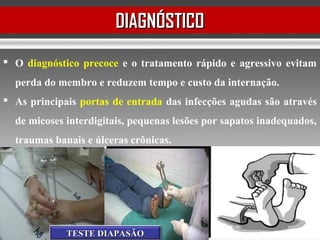 DIAGNÓSTICODIAGNÓSTICO
 O diagnóstico precoce e o tratamento rápido e agressivo evitam
perda do membro e reduzem tempo e custo da internação.
 As principais portas de entrada das infecções agudas são através
de micoses interdigitais, pequenas lesões por sapatos inadequados,
traumas banais e úlceras crônicas.
TESTE DIAPASÃOTESTE DIAPASÃO
 