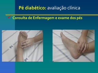pé diabéticooo.pptx enfermagemmmmmmmmmmm