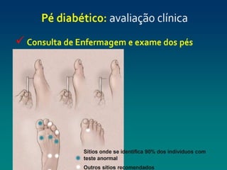 pé diabéticooo.pptx enfermagemmmmmmmmmmm