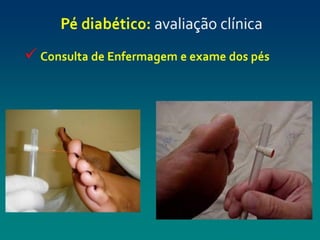 pé diabéticooo.pptx enfermagemmmmmmmmmmm
