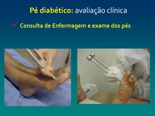 pé diabéticooo.pptx enfermagemmmmmmmmmmm