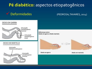 pé diabéticooo.pptx enfermagemmmmmmmmmmm