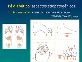 pé diabéticooo.pptx enfermagemmmmmmmmmmm