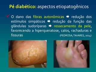 pé diabéticooo.pptx enfermagemmmmmmmmmmm