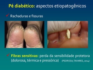 pé diabéticooo.pptx enfermagemmmmmmmmmmm
