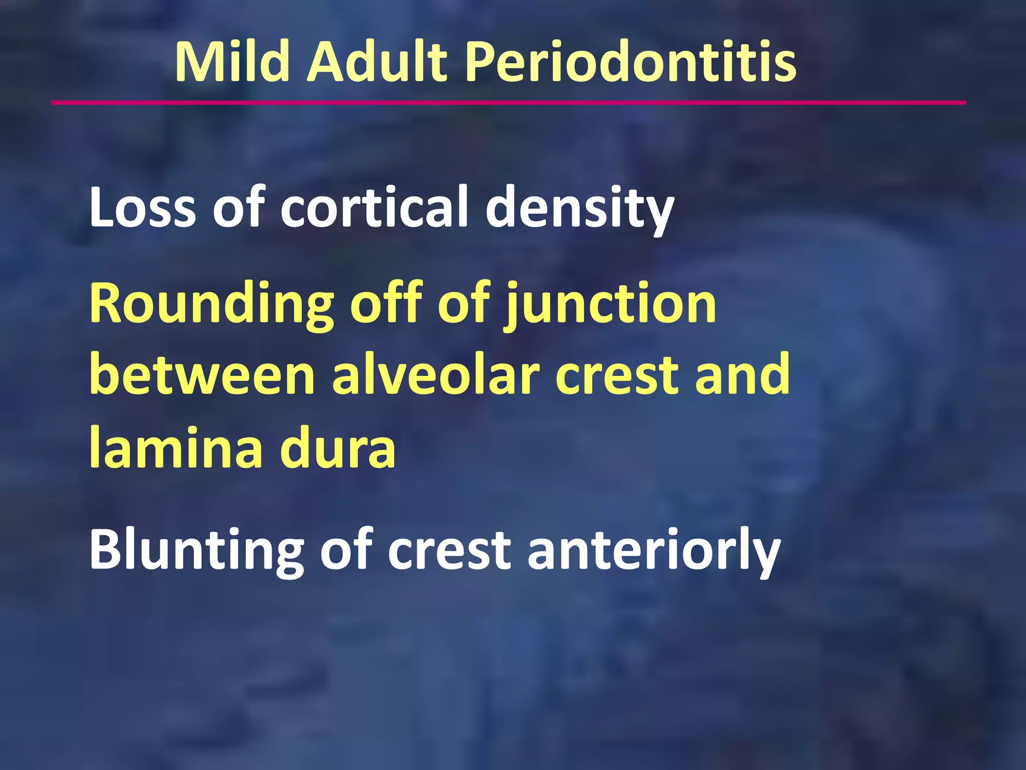 Mild Adult Periodontitis

Loss of cortical density
Rounding off of junction
between alveolar crest and
lamina dura
Blunting of crest anteriorly
 